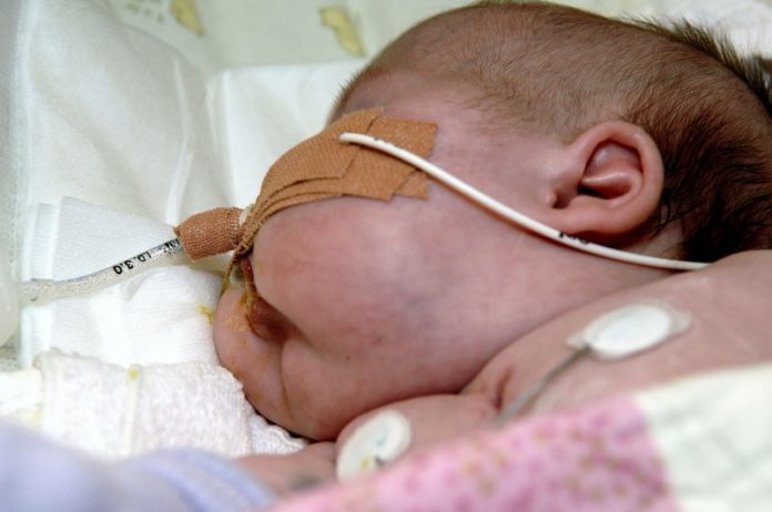 766587a11a5350eaea3cdf6485dbb25f-800x531