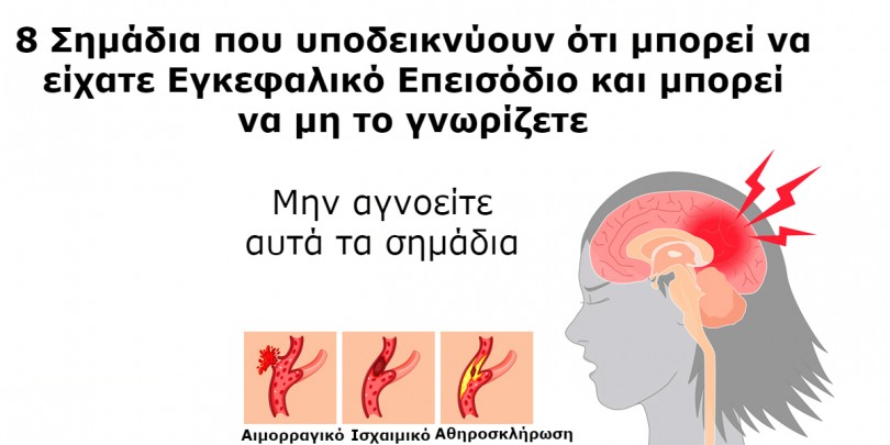 8 Σημάδια που δείχνουν ότι μπορεί να περάσατε ένα Μίνι-Εγκεφαλικό επεισόδιο ΧΩΡΙΣ να το Καταλάβετε. Ανοίξετε τα Μάτια σας!